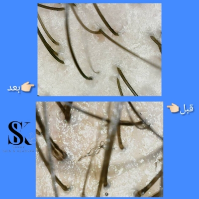 پاکسازی تخصصی پوست صورت